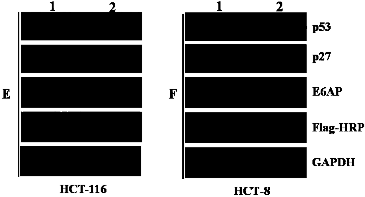 Experimental method for promoting growth and metastasis of colon cancer cells by lentivirus overexpression vector mediated E6-AP