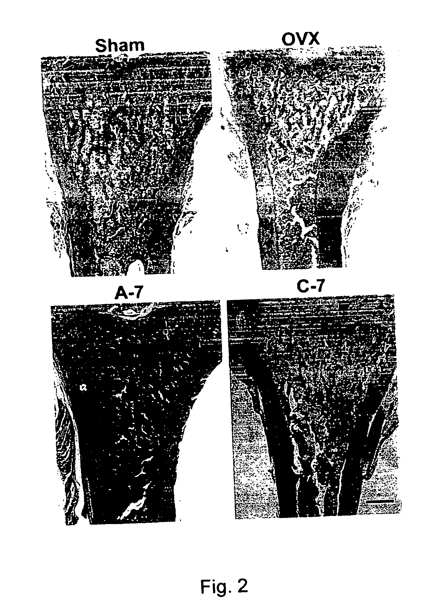 Pharmaceutical formulation for oral delivery of bisphosphates