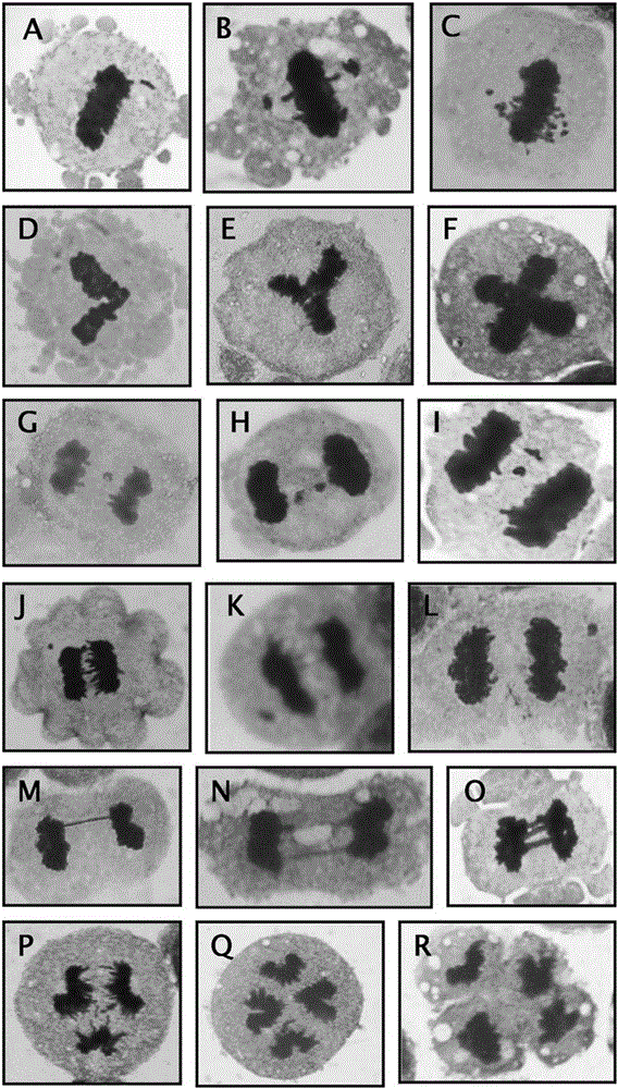 Method for detecting instability of human cell mitotic chromosomes in vitro