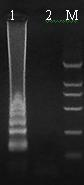 Loop-mediated isothermal amplification technology-based plasmodium genus and species nucleic acid screening method