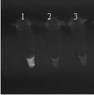 Loop-mediated isothermal amplification technology-based plasmodium genus and species nucleic acid screening method