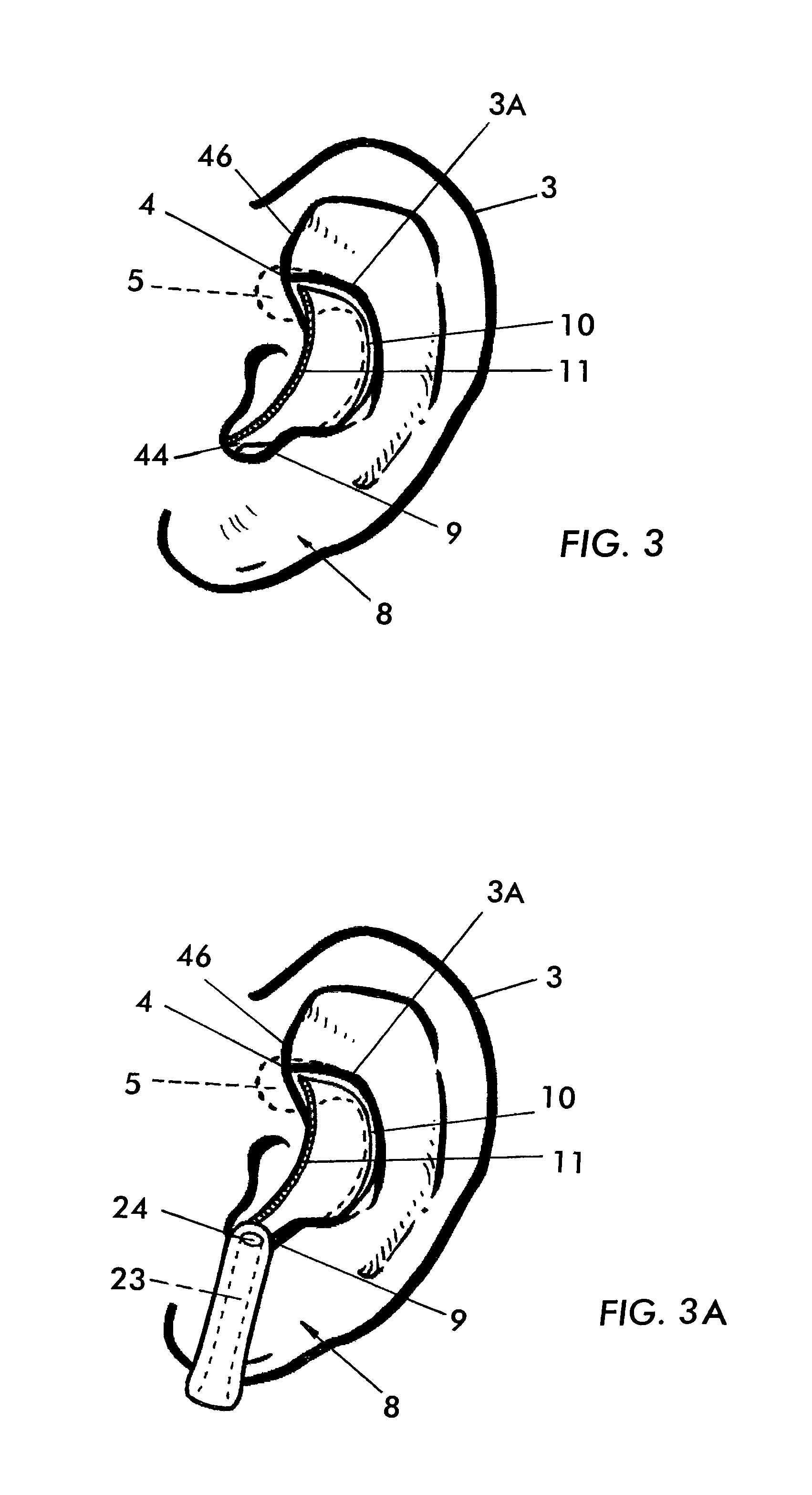 External ear insert for hearing comprehension enhancement