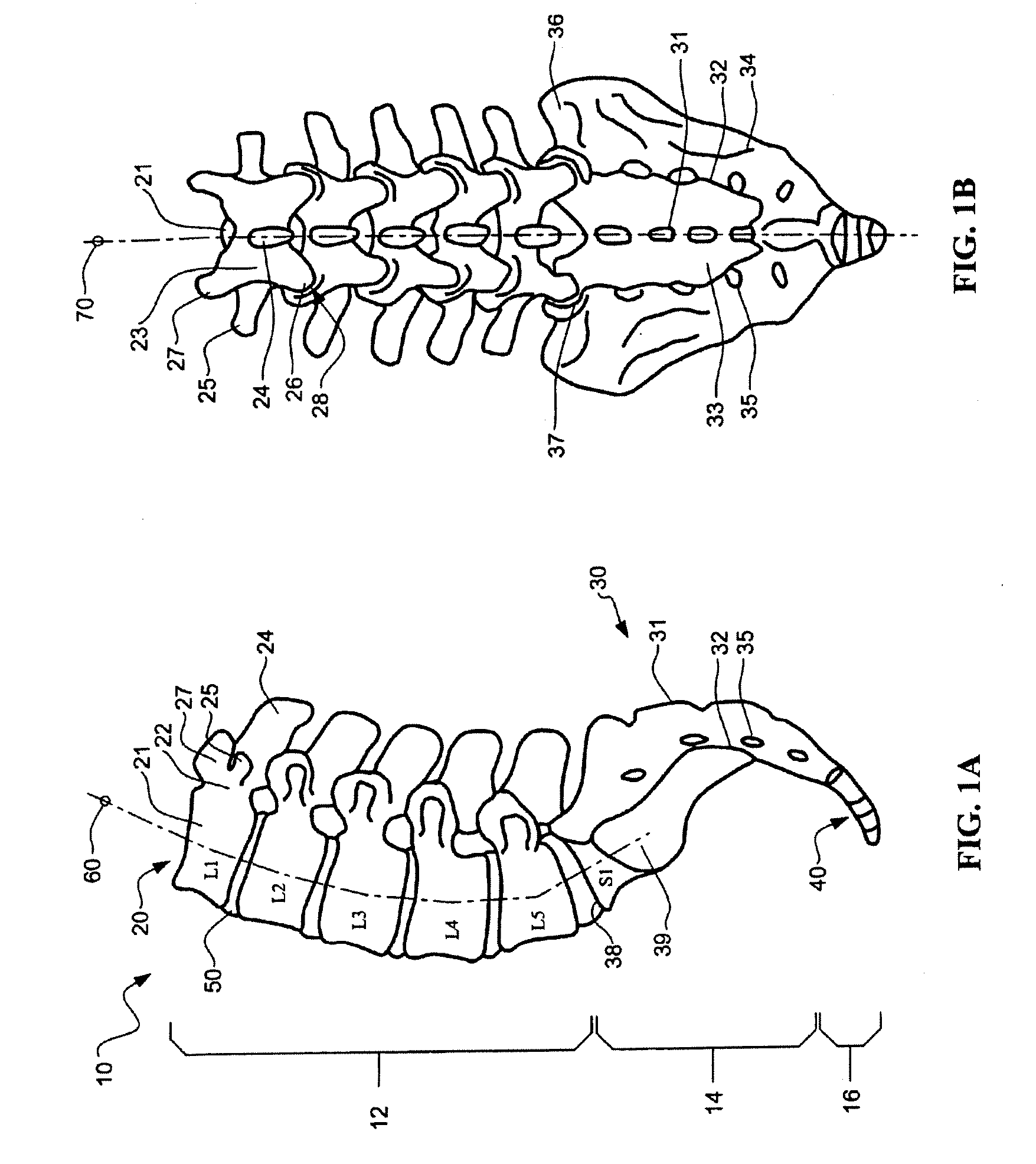 Devices and methods for annular repair of intervertebral discs