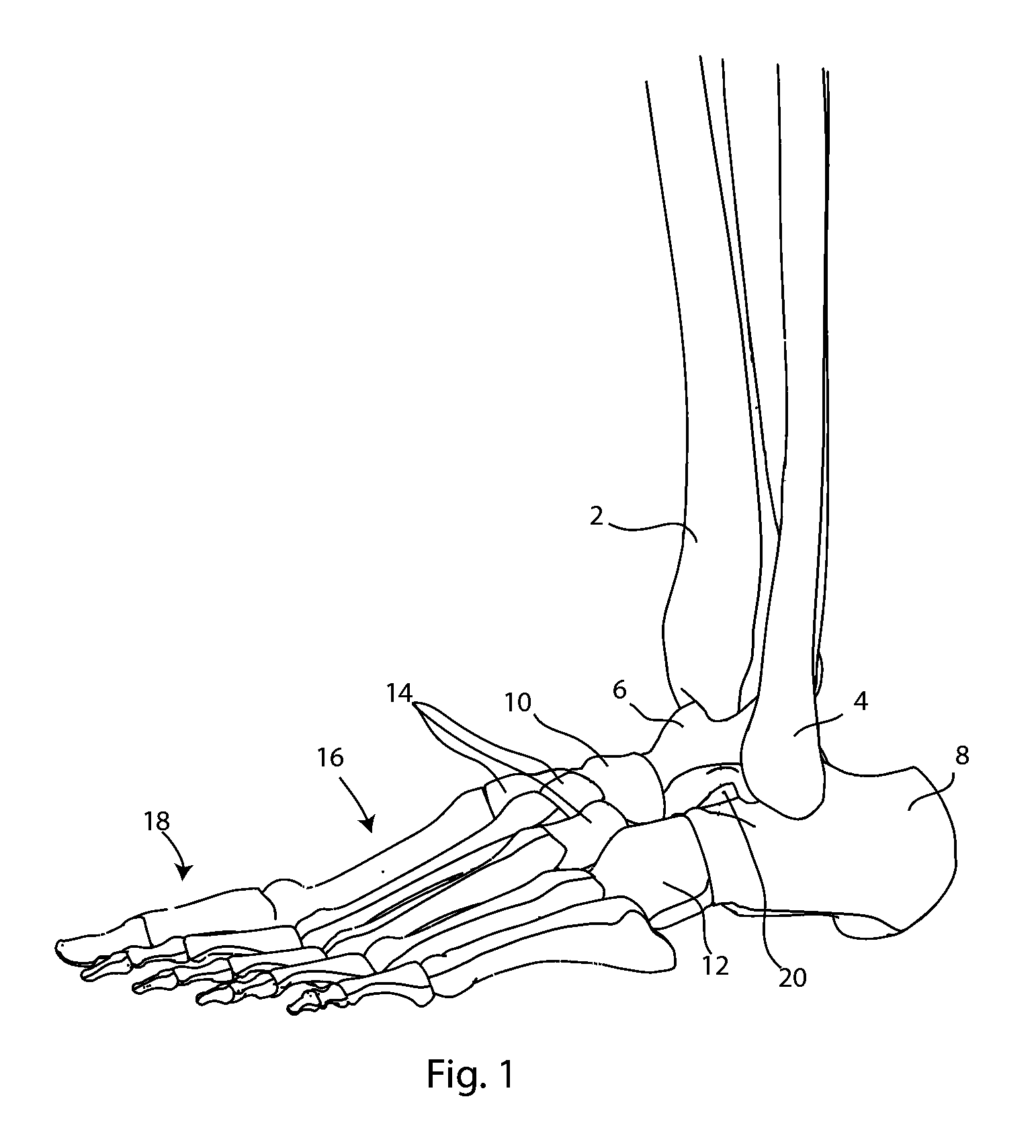 Joint Arthrodesis and Arthroplasty