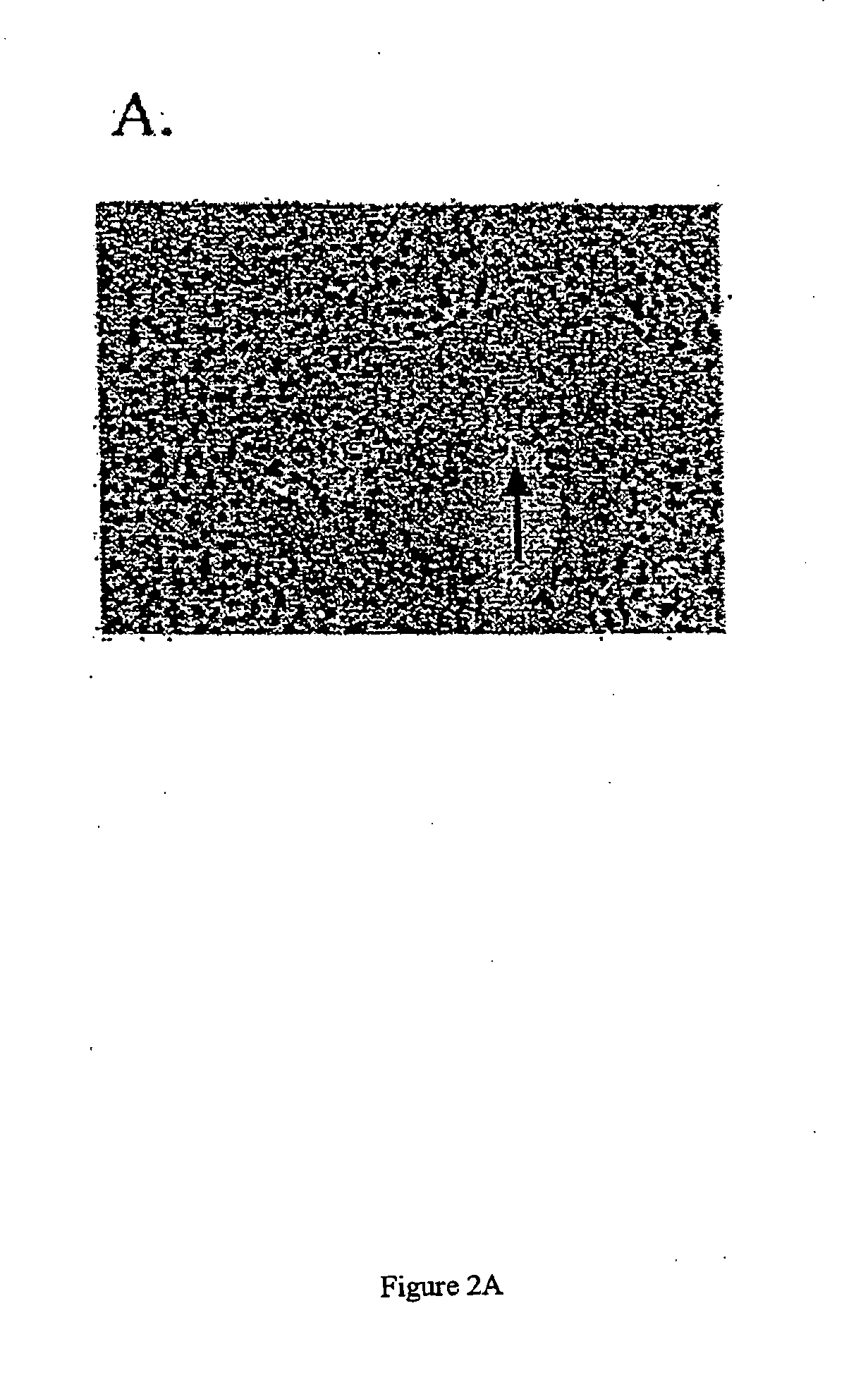 Methods for Diagnosis and Treatment of Endometrial Cancer