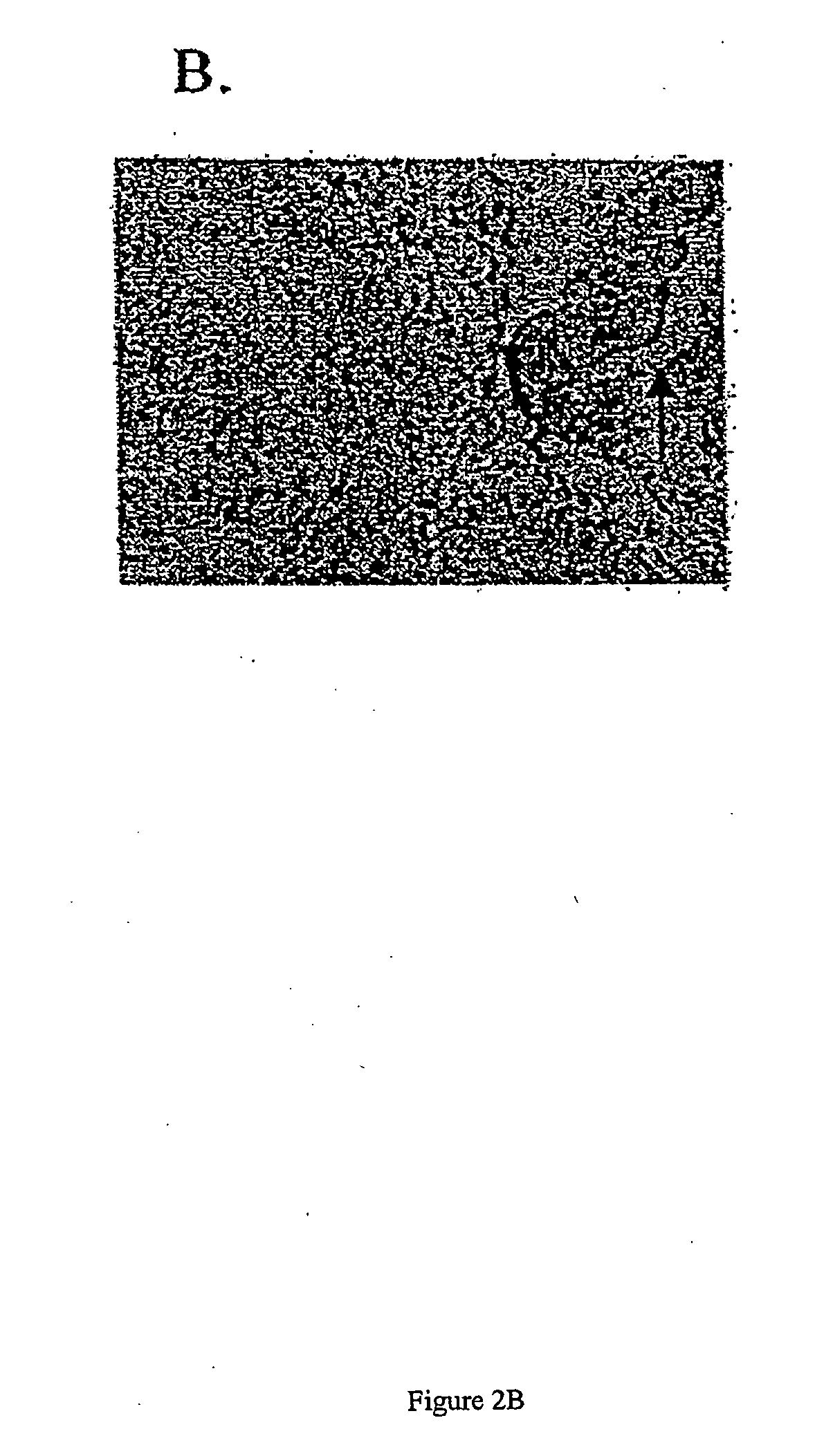 Methods for Diagnosis and Treatment of Endometrial Cancer