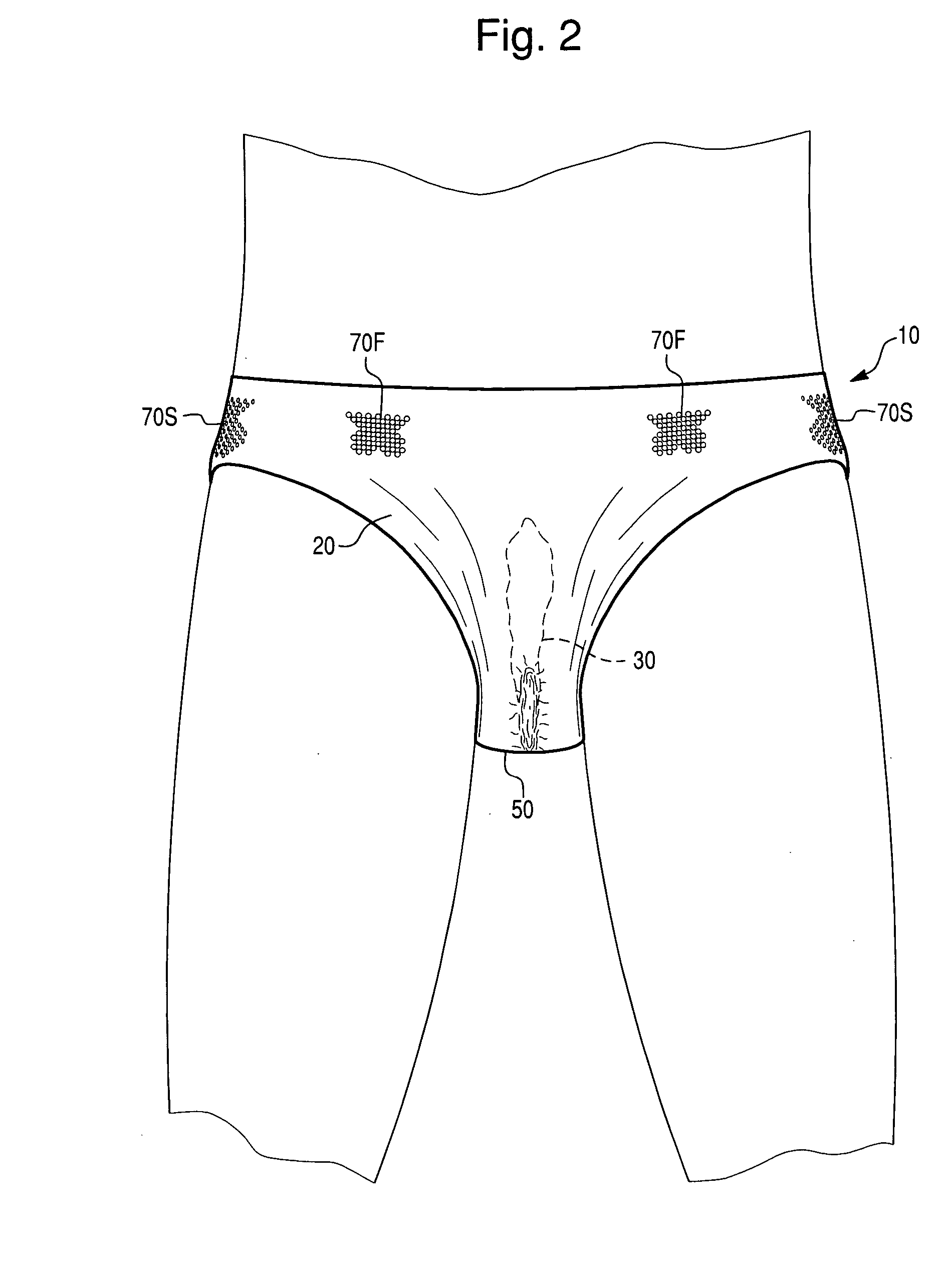 Prophylactic device