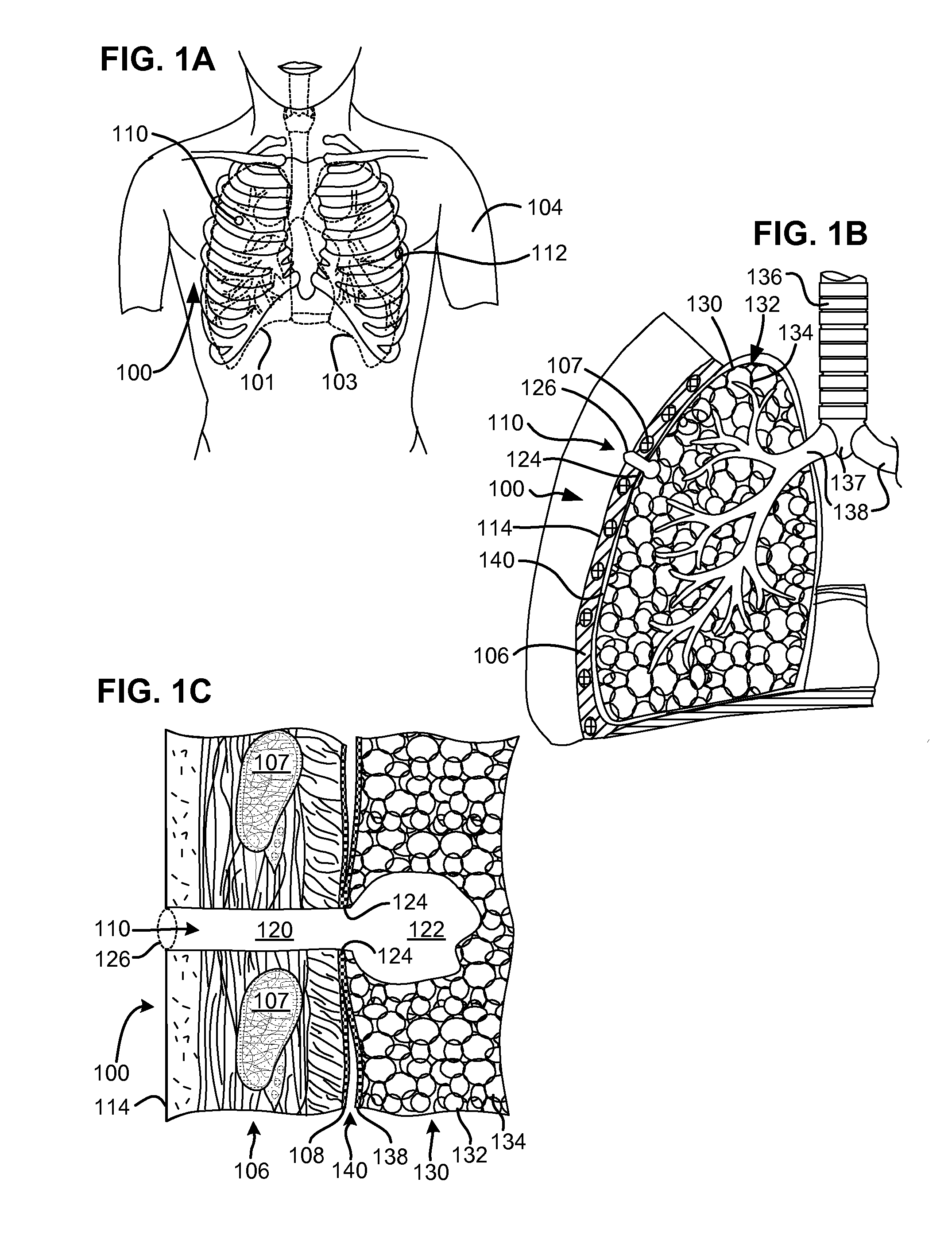 Methods and devices for assessment of pneumostoma function