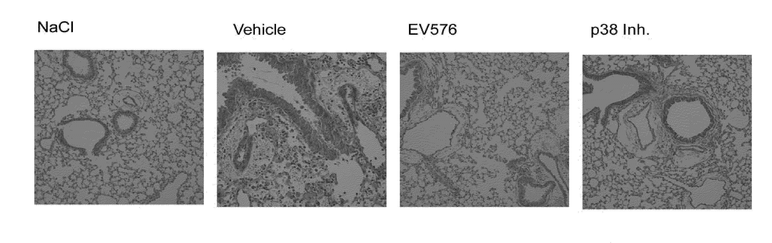 Method of treating respiratory disorders