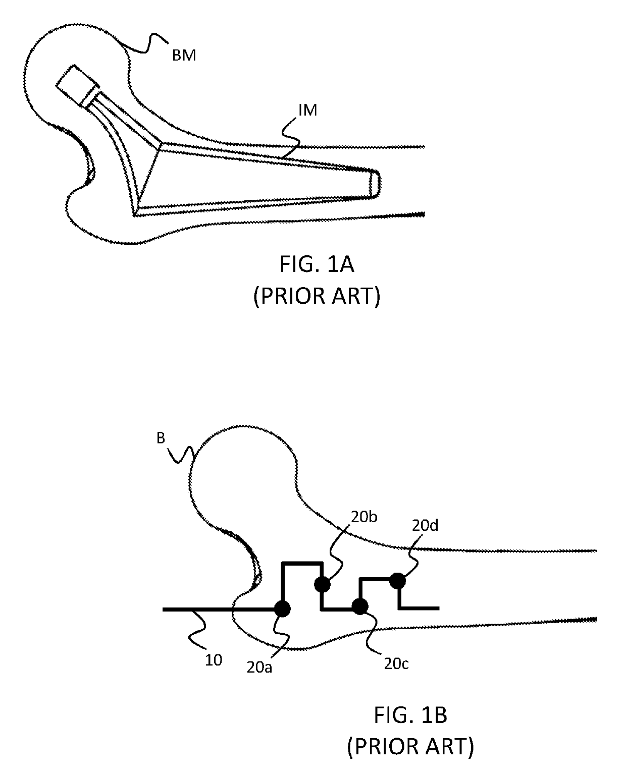 Environmental mapping for robotic assisted surgery