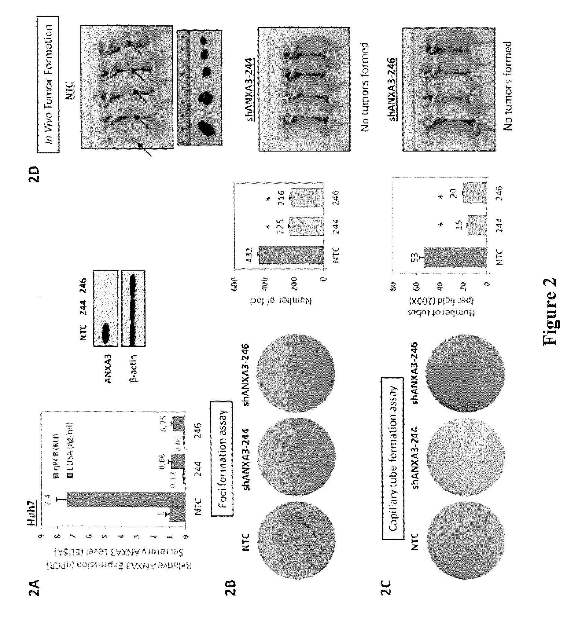 Use of annexin A3 as a diagnostic and prognostic biomarker and therapeutic target for treating hepatocellular carcinoma