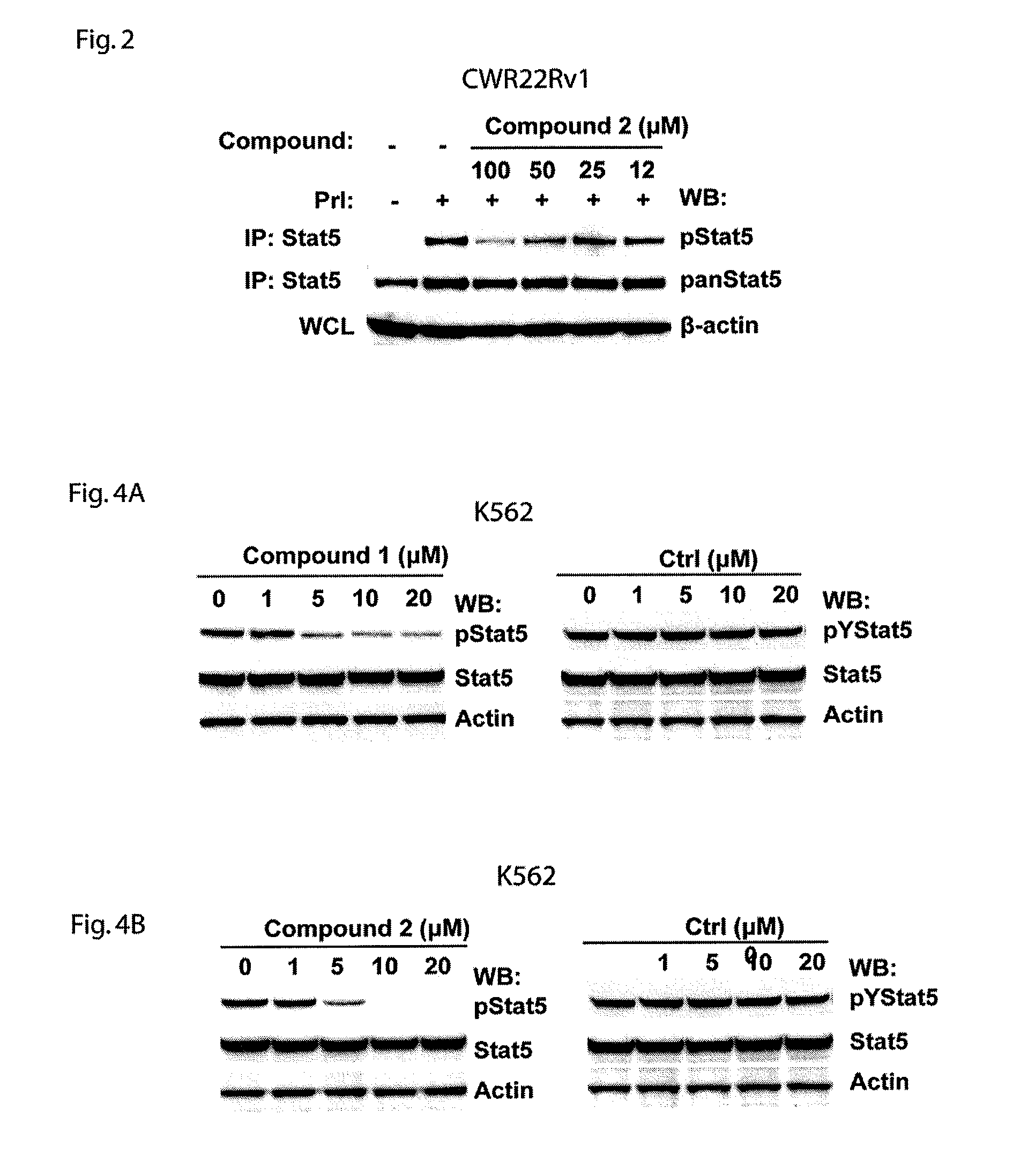 Treatment of prostate cancer and hematologic neoplasms