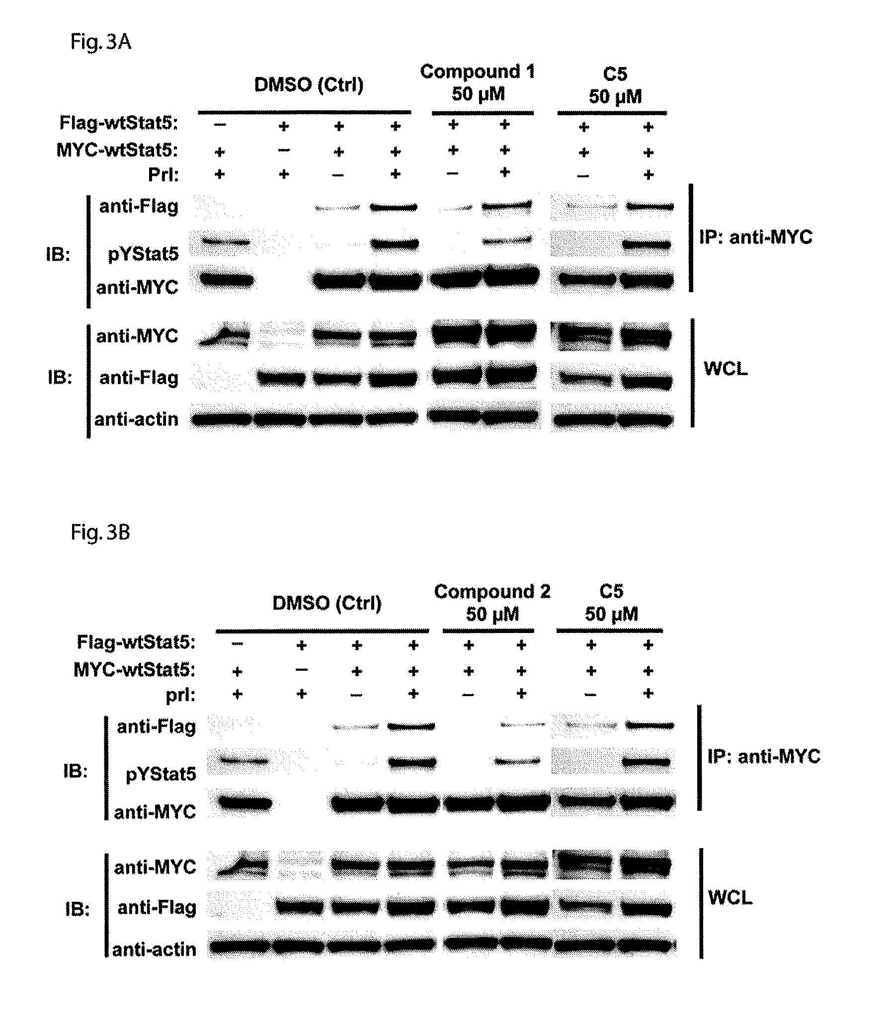 Treatment of prostate cancer and hematologic neoplasms