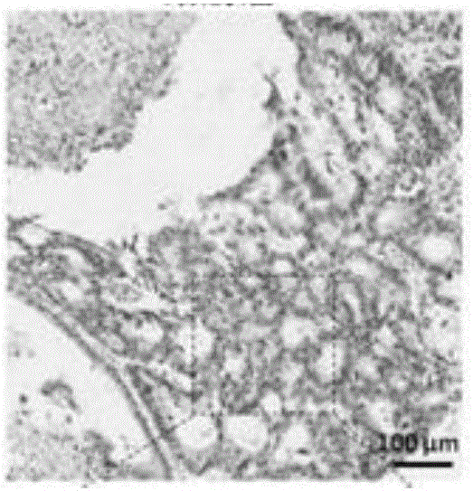 Colon cancer prognosis prediction marker and detection method thereof