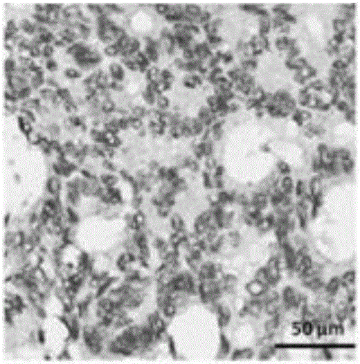 Colon cancer prognosis prediction marker and detection method thereof