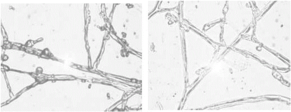 Trichoderma viride XJ-3 strain and method for preparing cotton stalk rotten organic fertilizer by using same