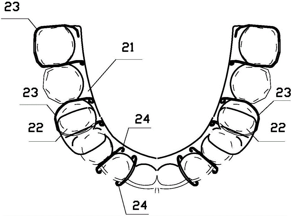 Orthopedic device stimulating lower mandibular advancement and inhibiting upper mandibular growth