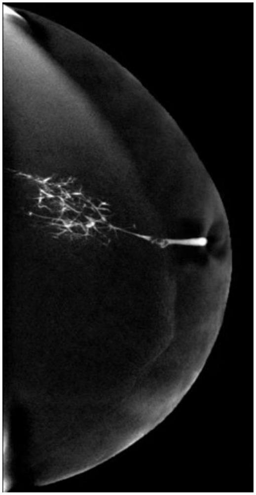 Application of CEM in mammary duct angiography and verification method