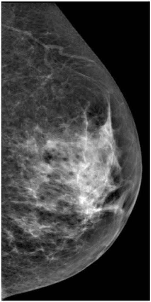 Application of CEM in mammary duct angiography and verification method