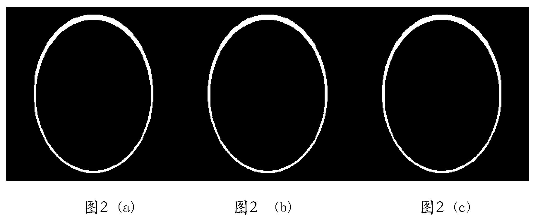 Image processing method based on sparse sampling magnetic resonance imaging