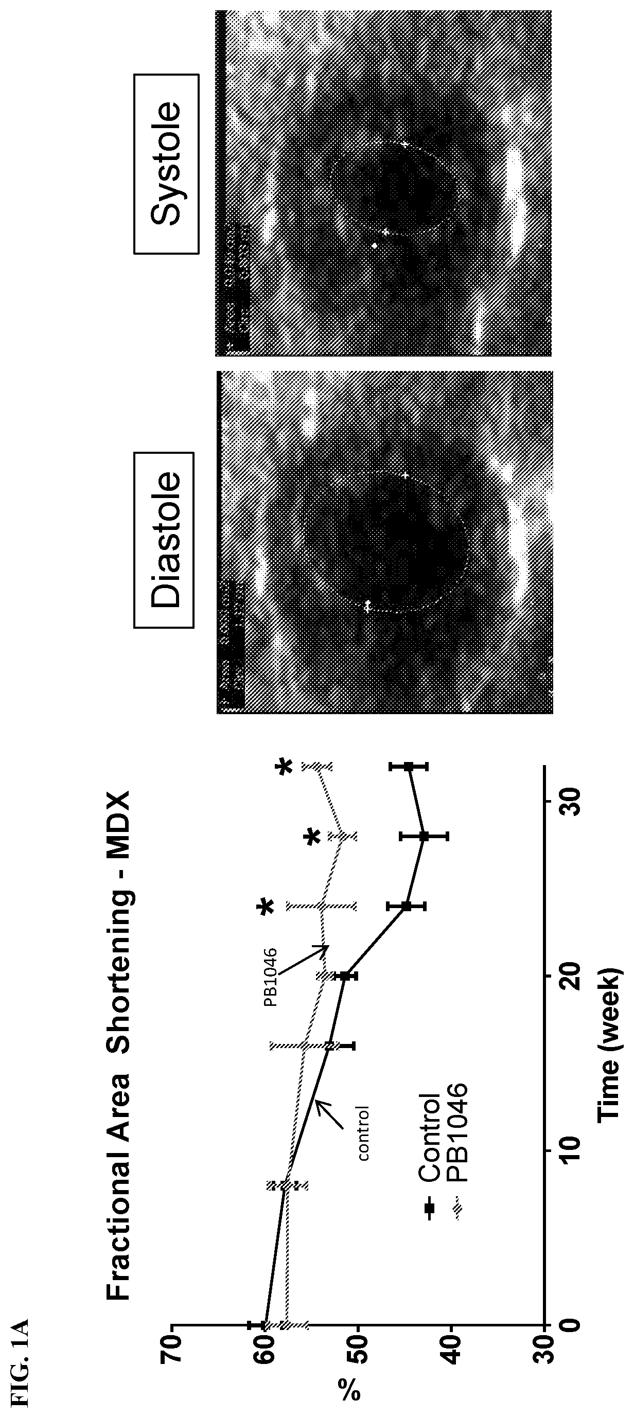 Methods and compositions for treating muscle disease and disorders