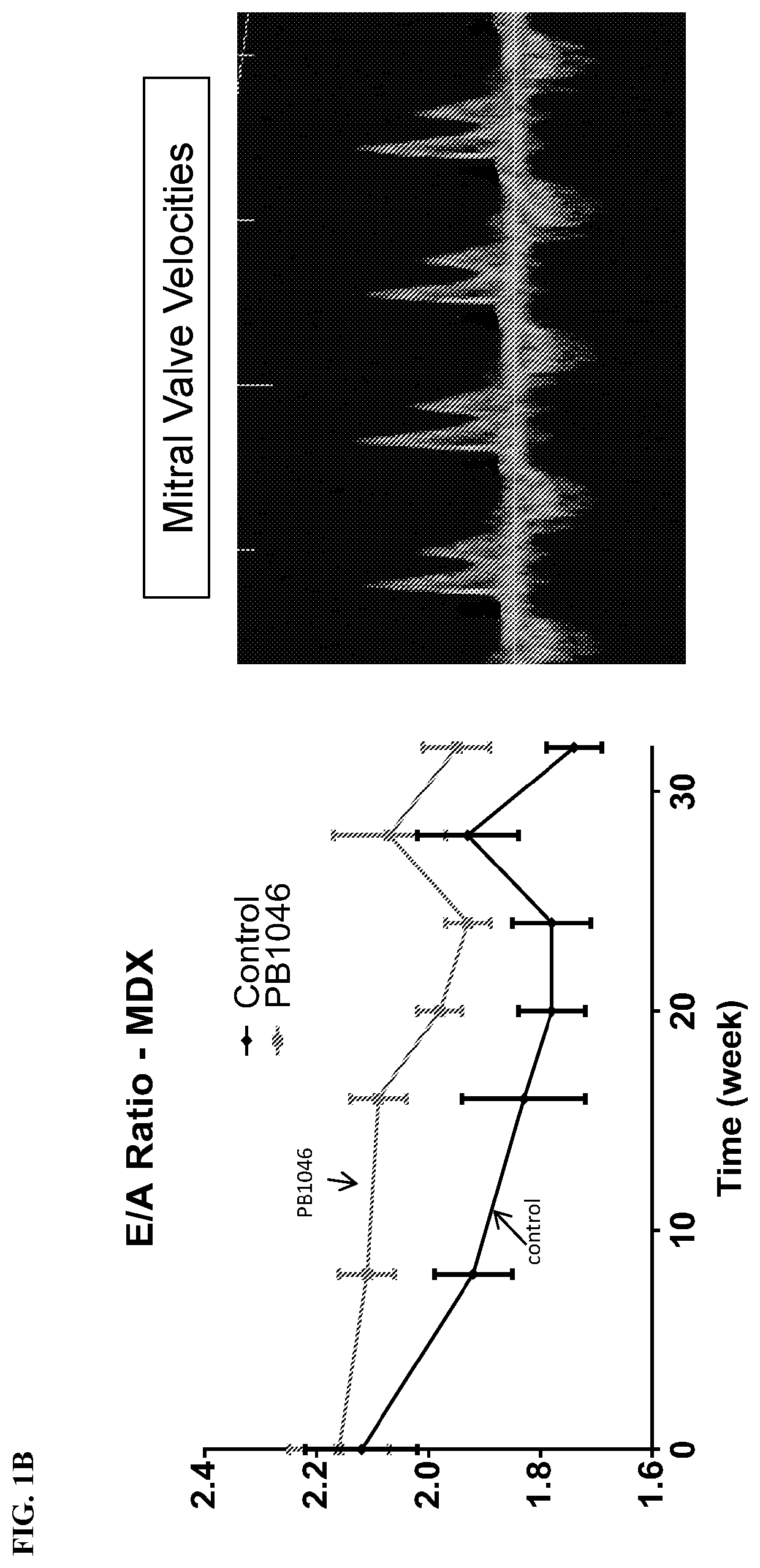 Methods and compositions for treating muscle disease and disorders