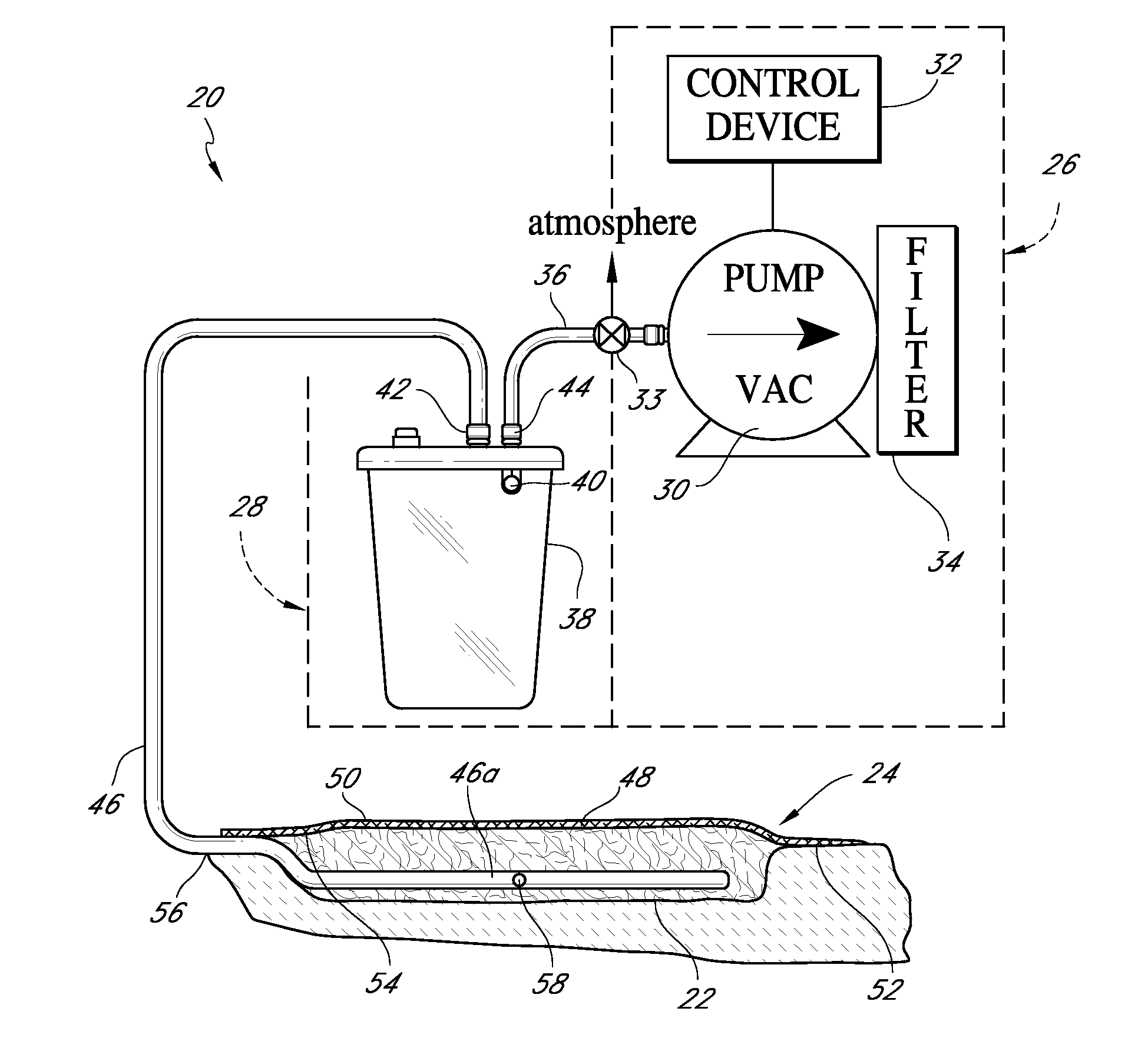 Sustained variable negative pressure wound treatment and method of controlling same