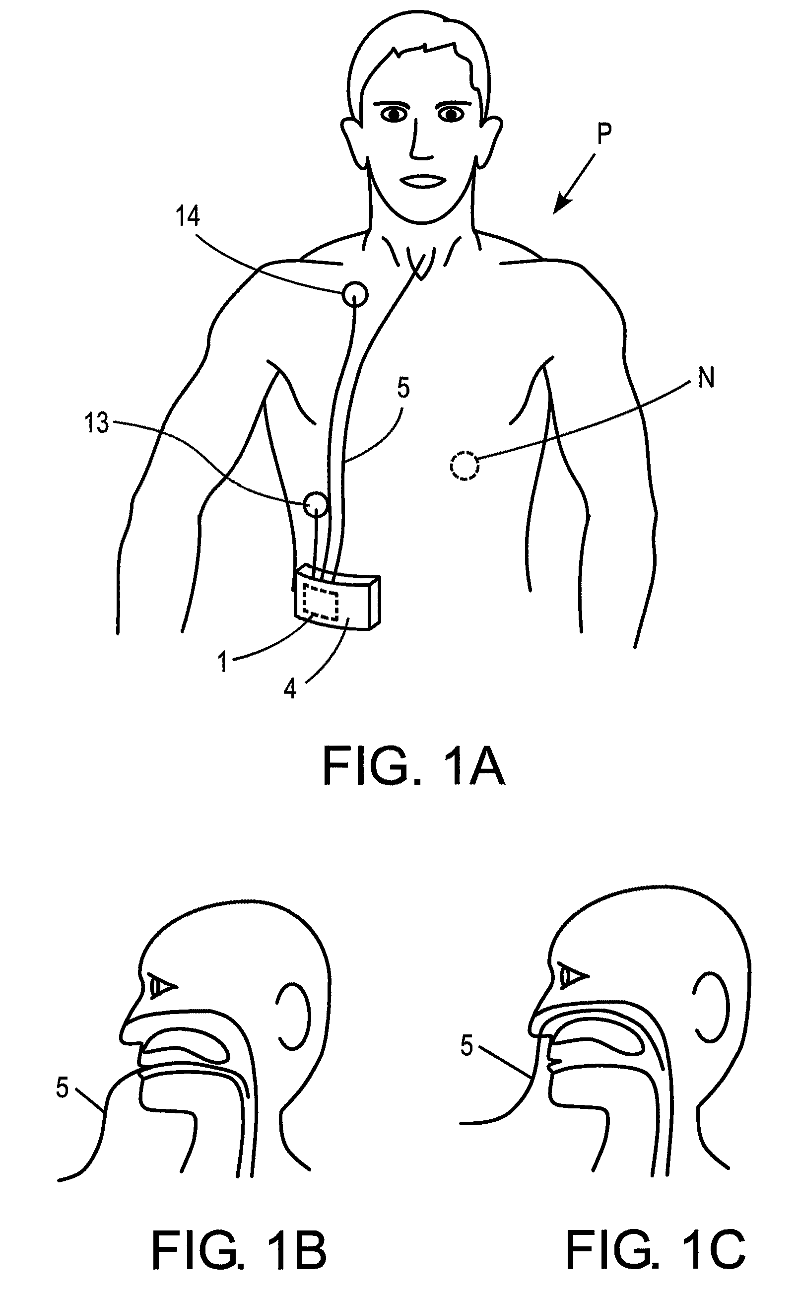 Systems, methods and apparatus for respiratory support of a patient