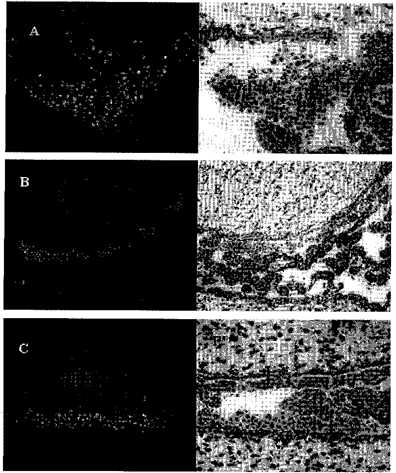 Application of amniotic epithelial cells in pharmacy