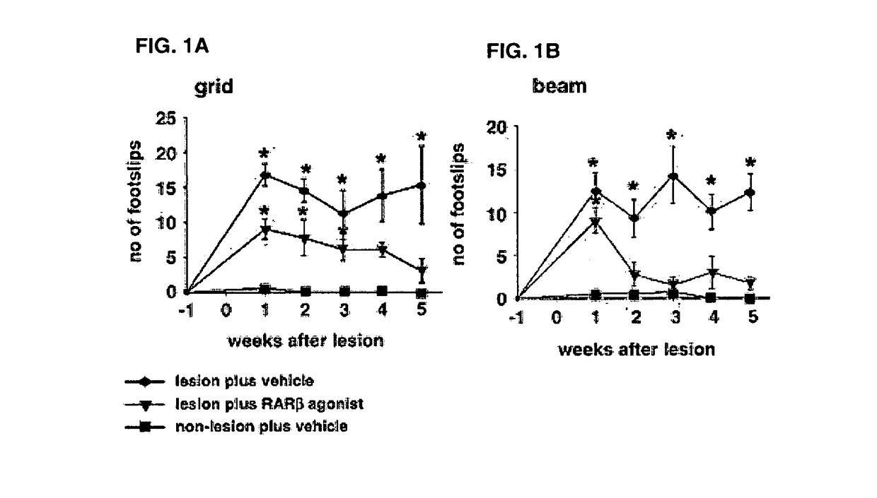 Bicycloheteroaryl-Heteroaryl-Benzoic Acid Compounds as Retinoic Acid Receptor Beta (RARBeta) Agonists