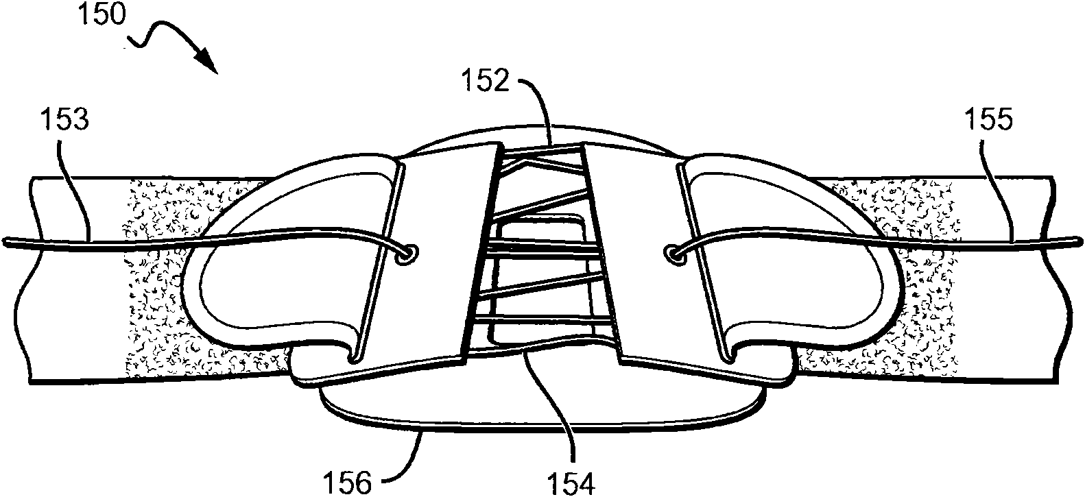 Highly adjustable lumbar support and methods