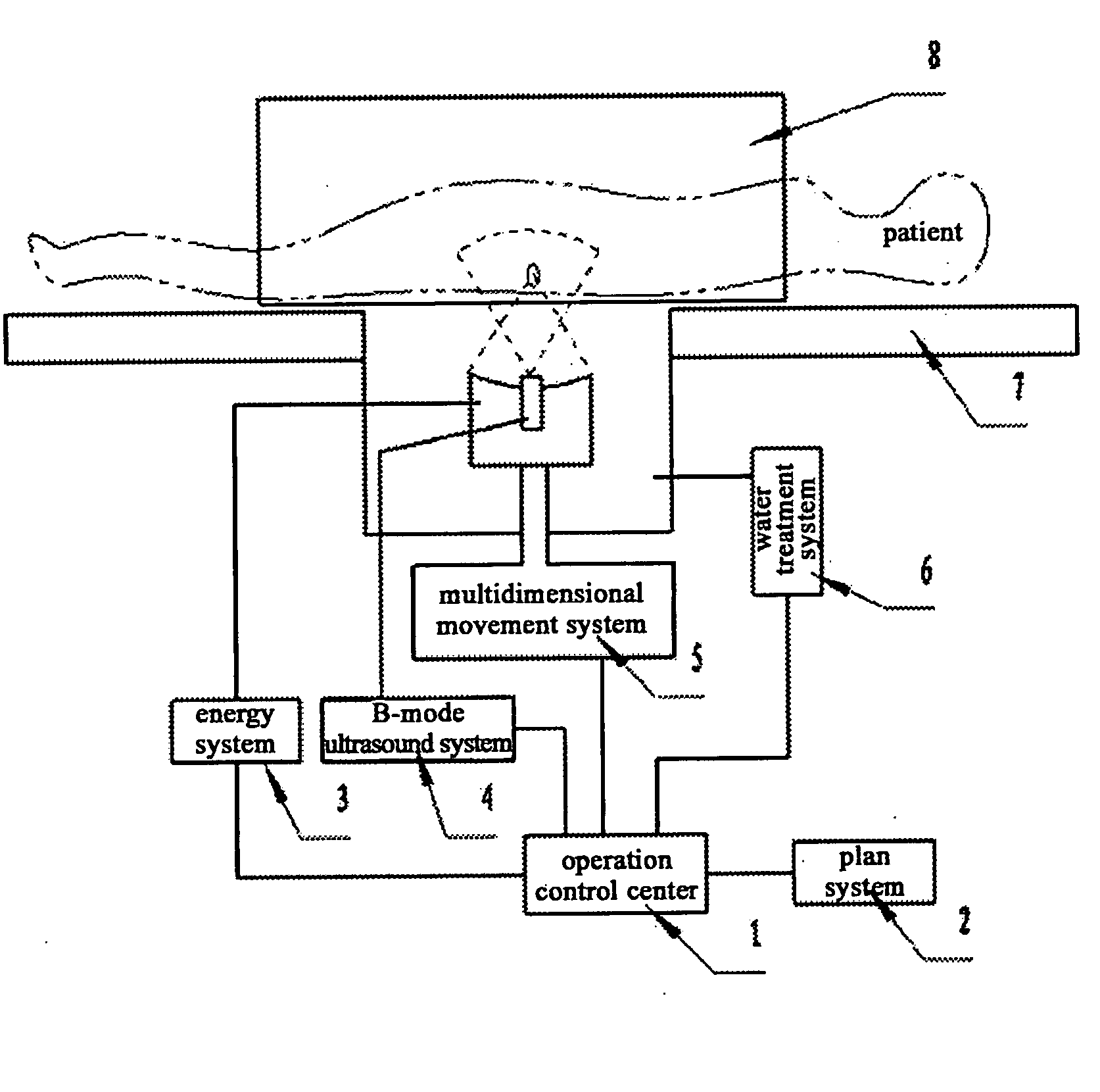 Focused Ultrasound Therapy System