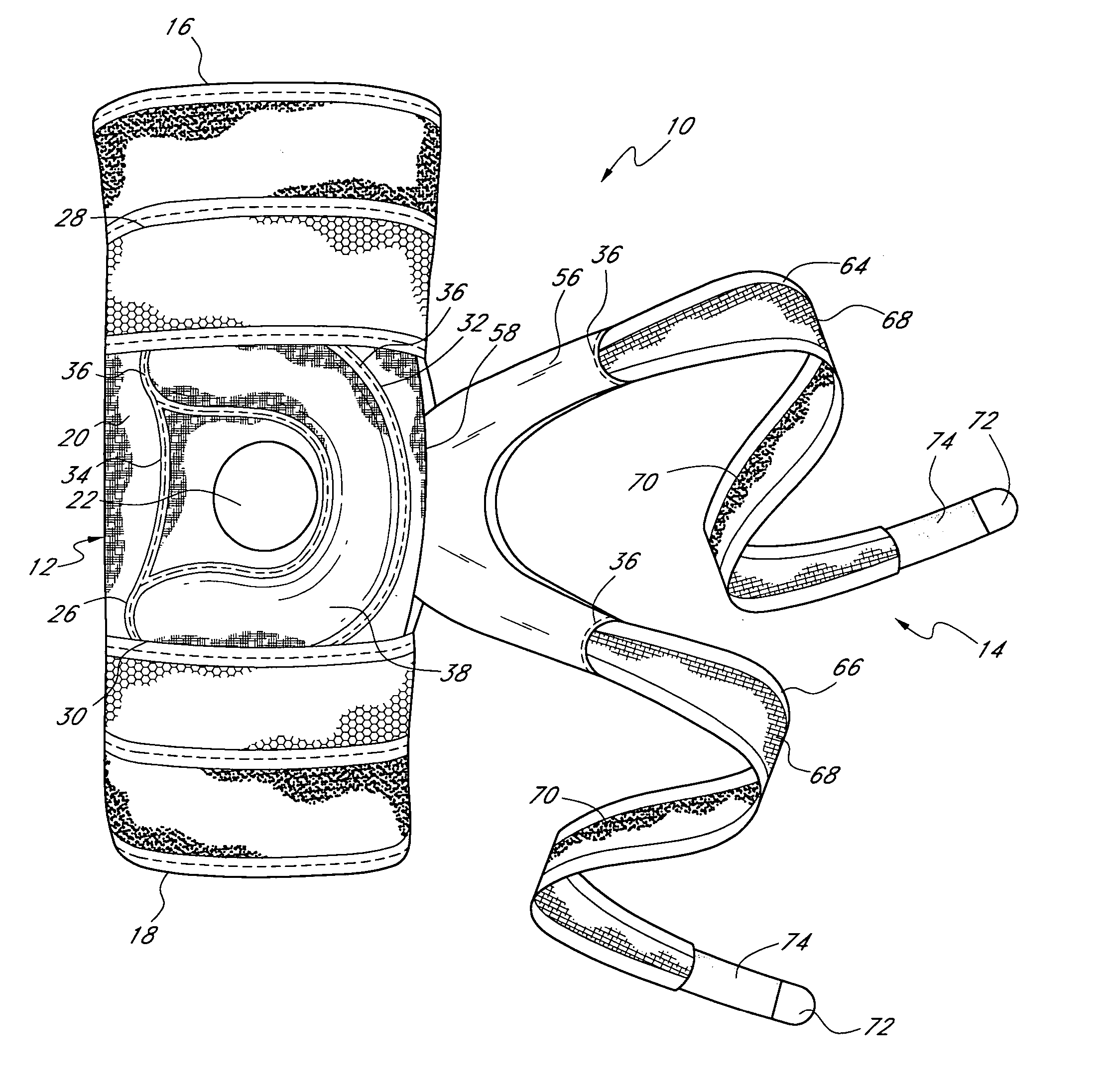 Patellofemoral brace