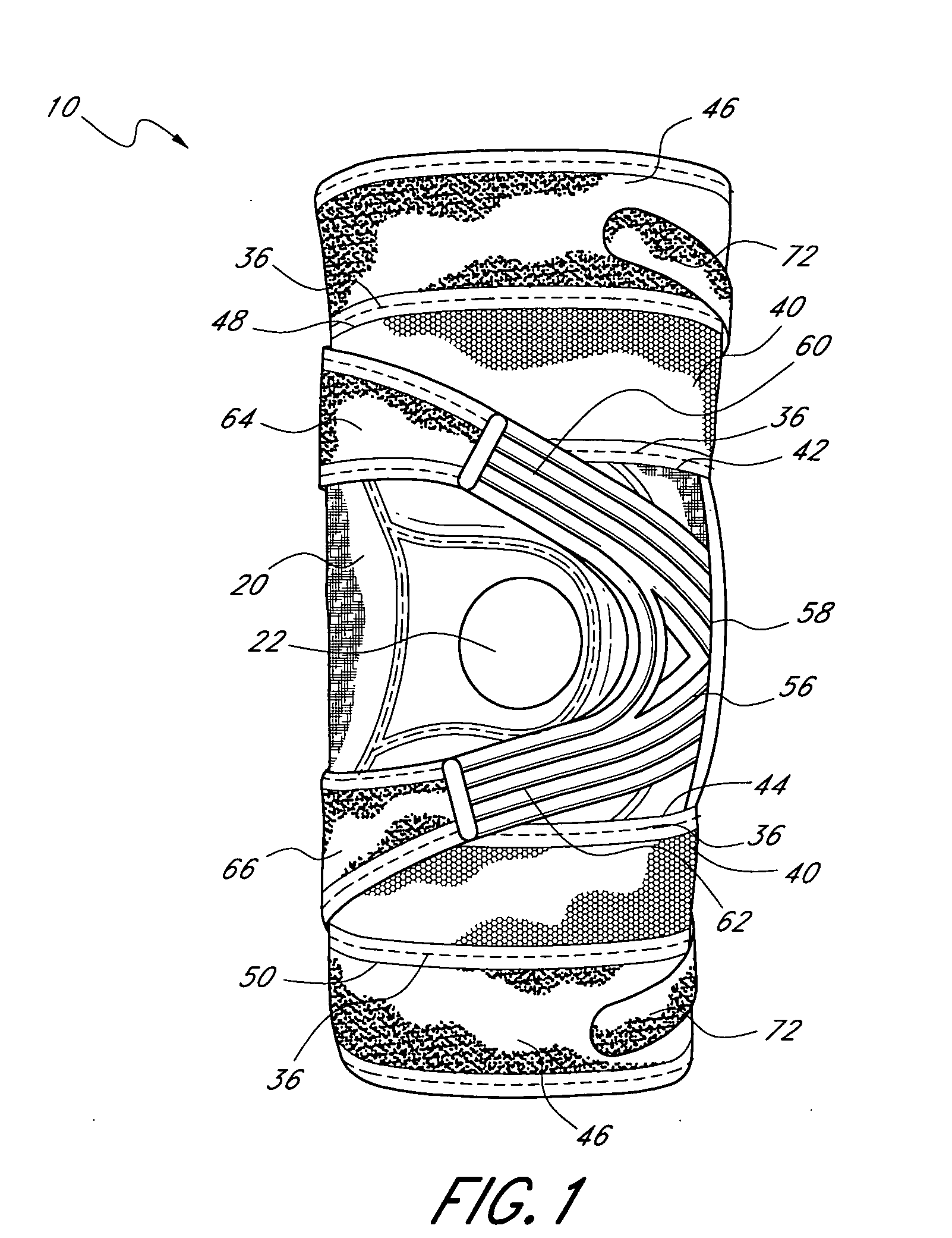 Patellofemoral brace