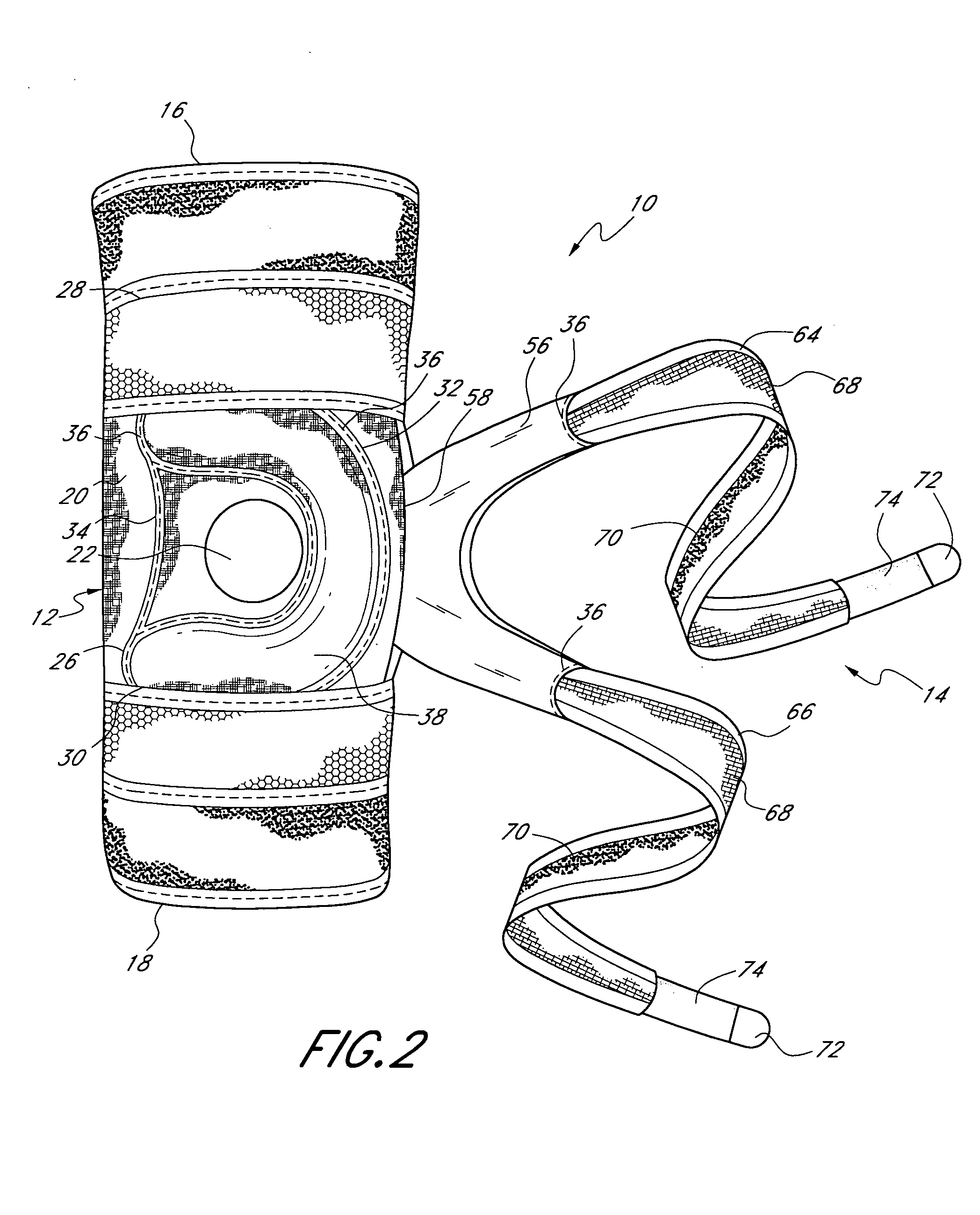 Patellofemoral brace