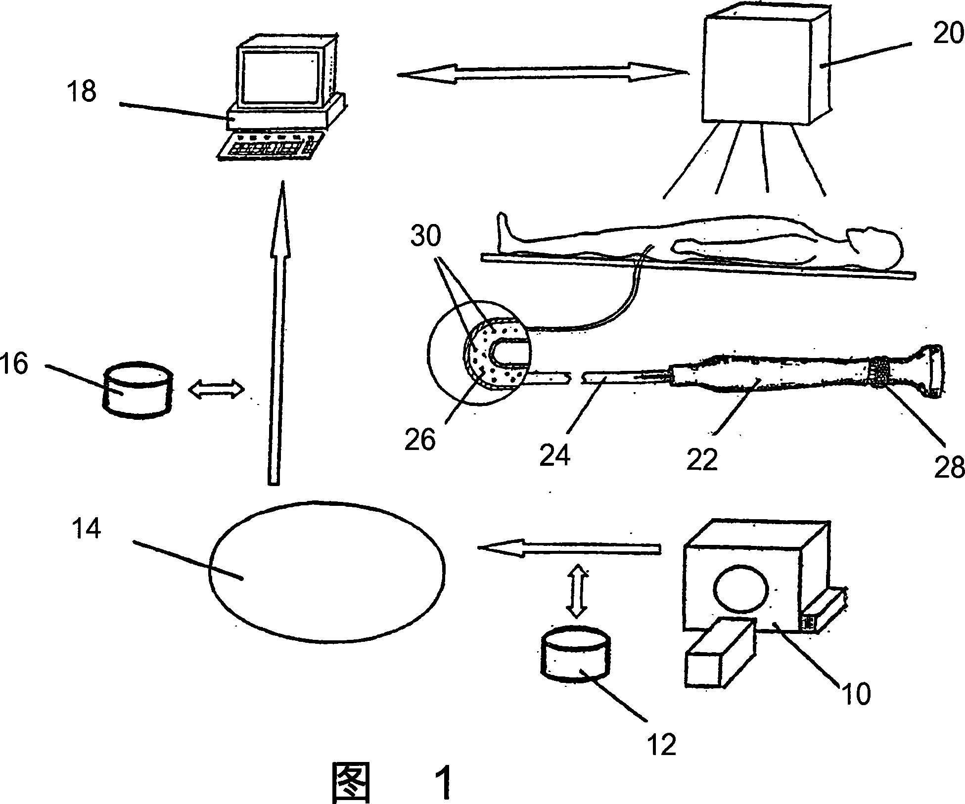 Method and system for treatment of atrial fibrillation and other cardiac arrhythmias