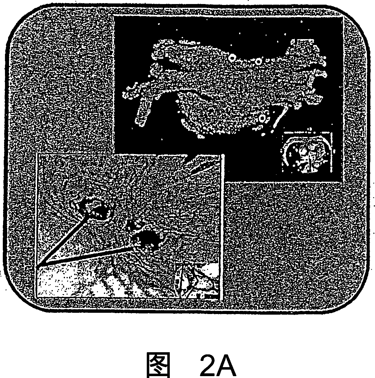 Method and system for treatment of atrial fibrillation and other cardiac arrhythmias