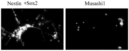 Immortalized human neural stem cell line and preparation method thereof, and recombinant virus vector and application thereof