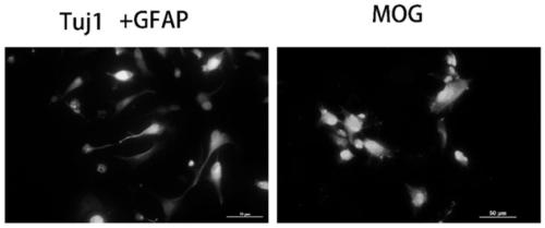 Immortalized human neural stem cell line and preparation method thereof, and recombinant virus vector and application thereof