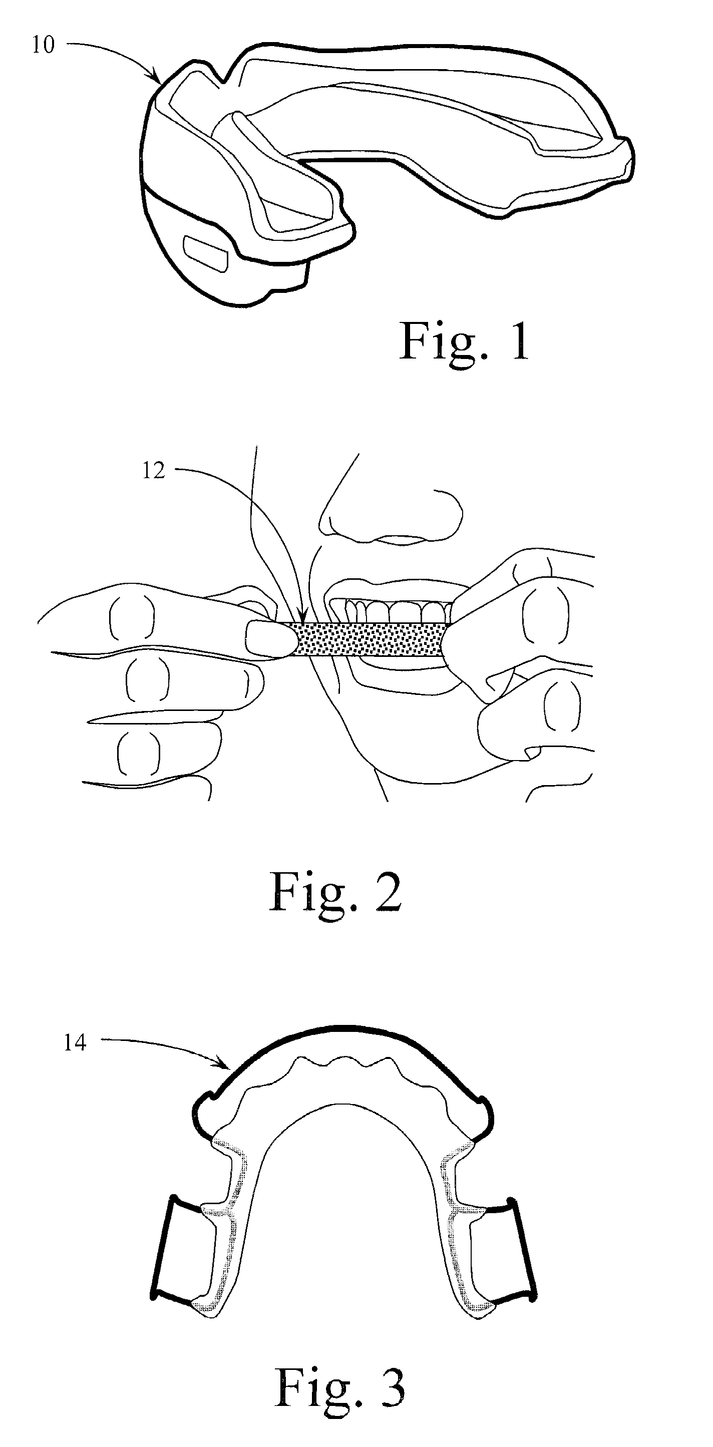 Trigeminal Nerve Stimulation Systems and Methods of Use