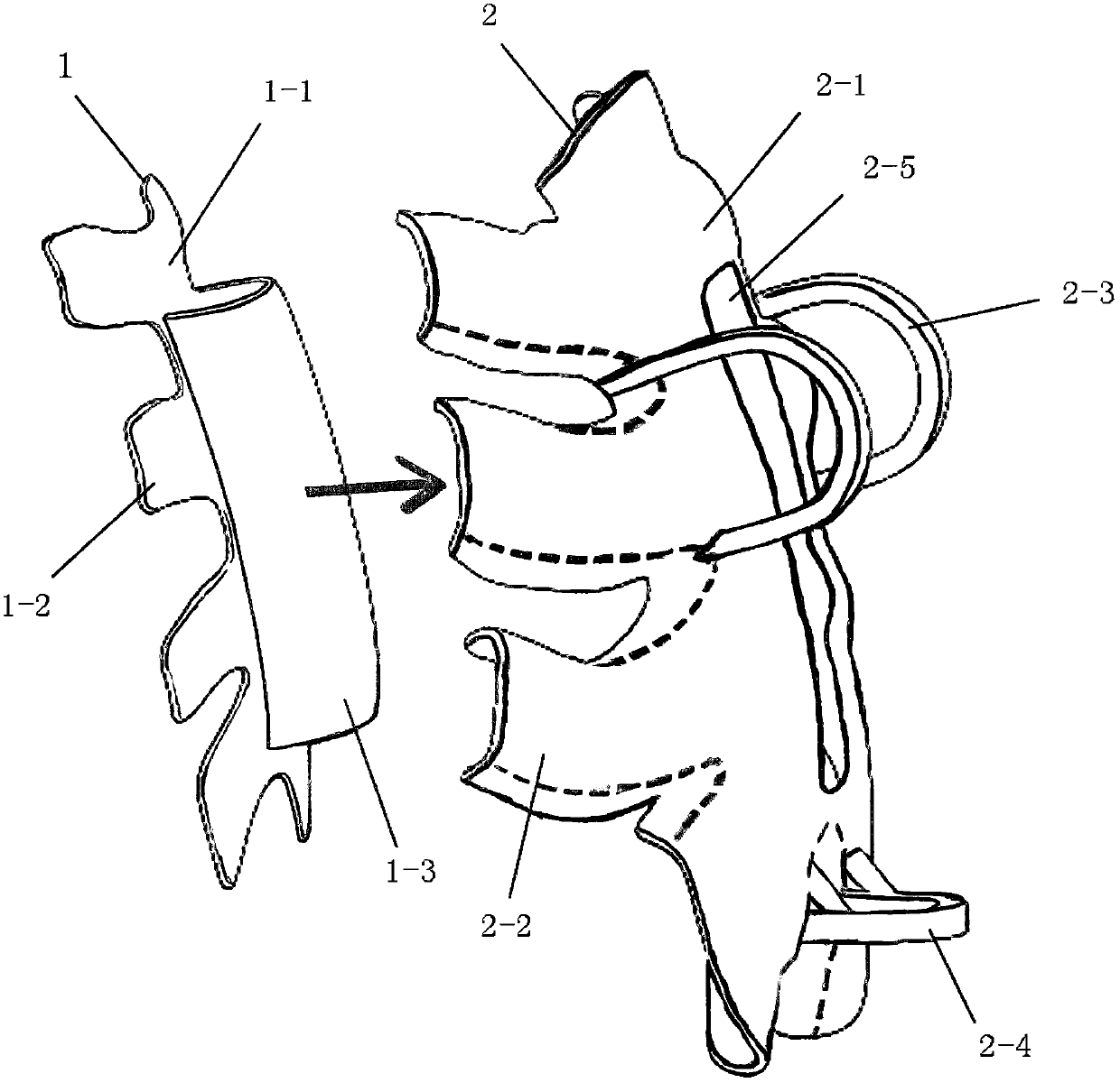 Guide plate for sternal reconstruction and manufacturing method thereof