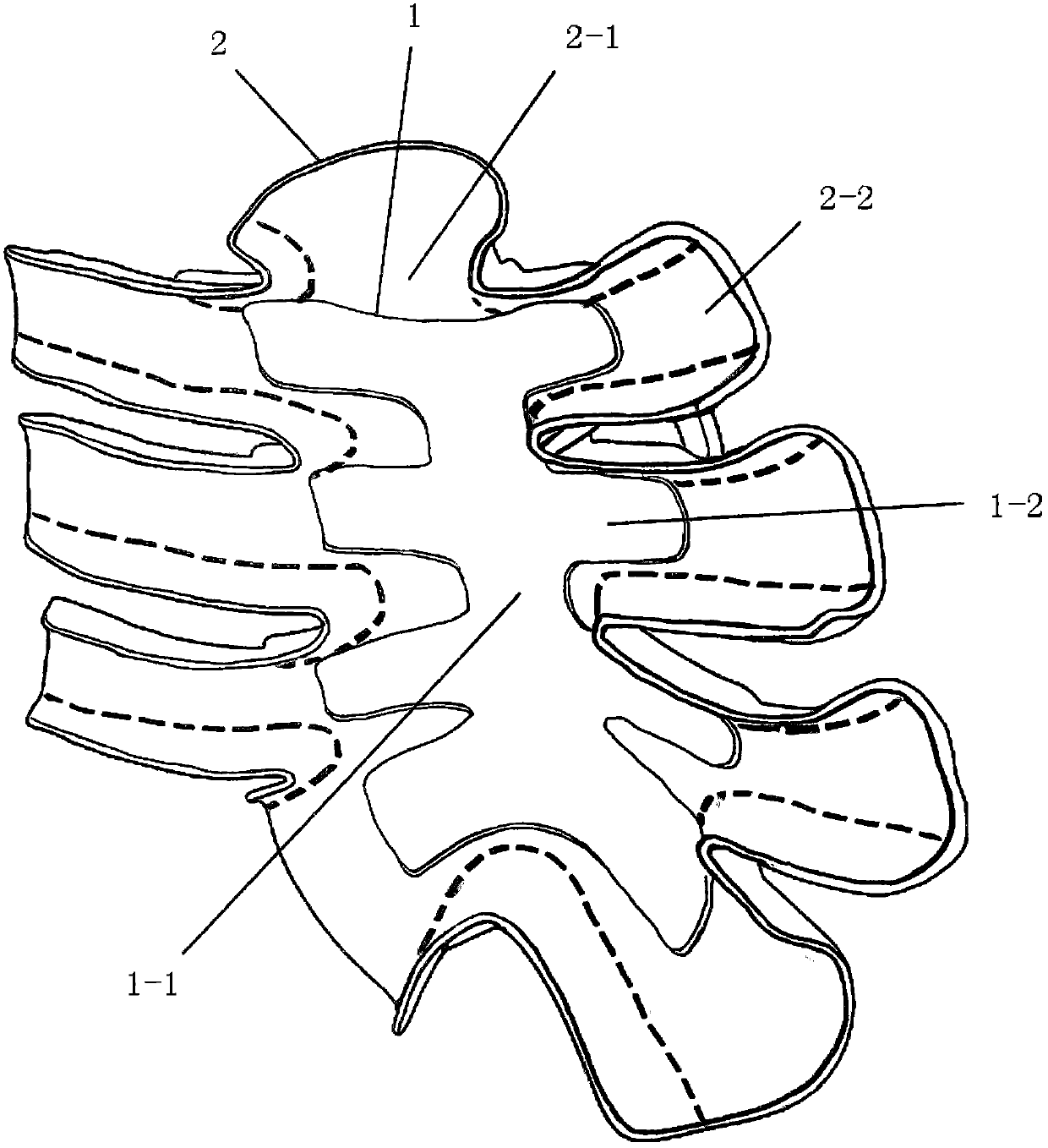 Guide plate for sternal reconstruction and manufacturing method thereof