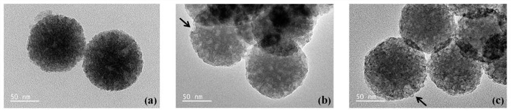 Preparation method and application of la-activated functionalized dendritic mesoporous silica nanospheres