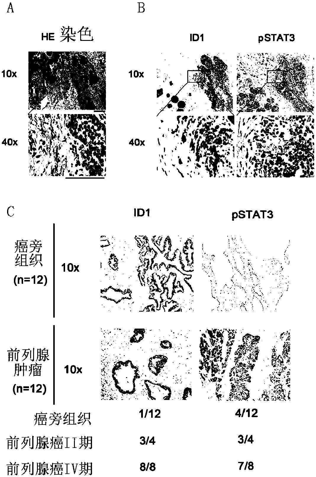 Prostate cancer markers and application thereof