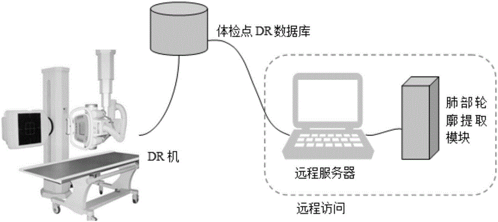 Method for extracting lung lobe contour from DR image