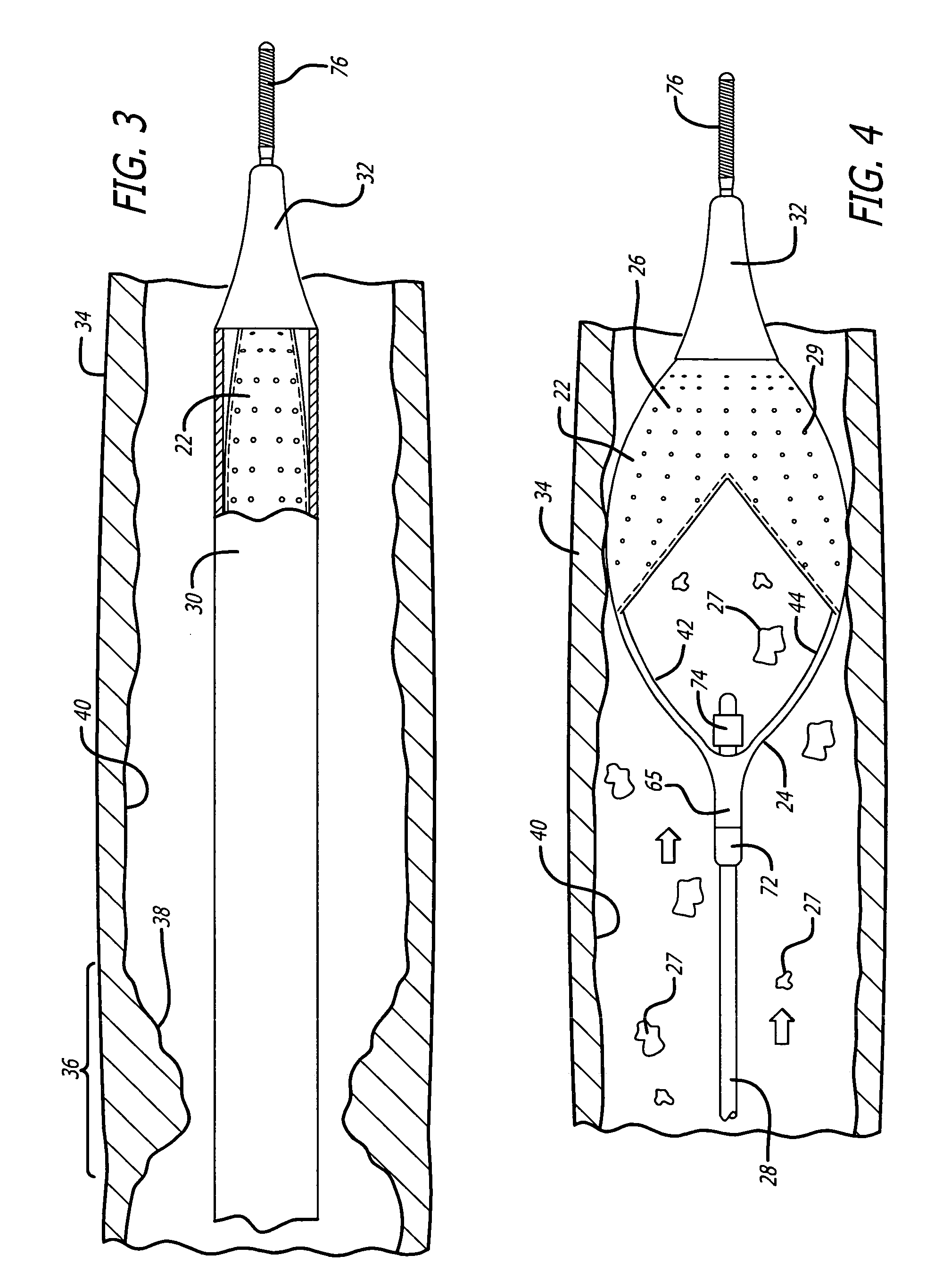 Flexible and conformable embolic filtering devices