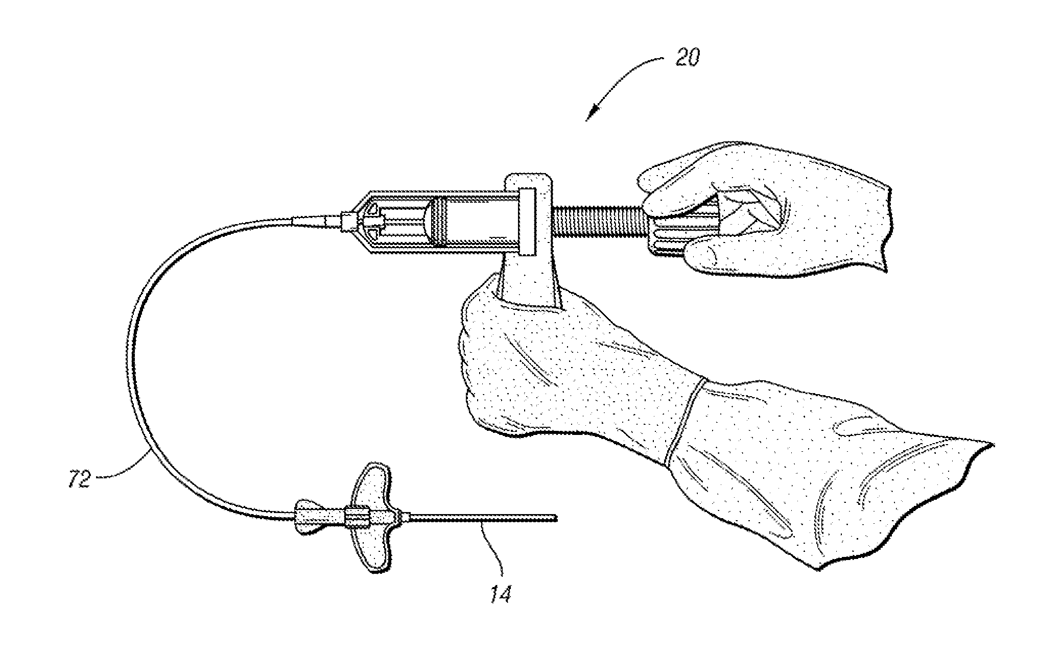 Bone cement mixing and delivery device and method of use