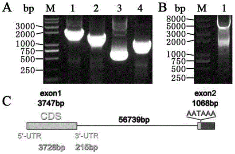 A kind of shrna that suppresses irs1 gene expression and application