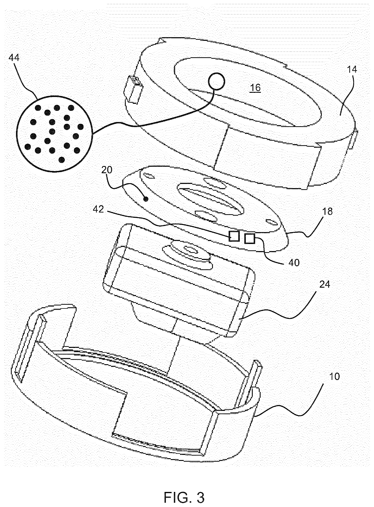 Ultrasound probe arrangement