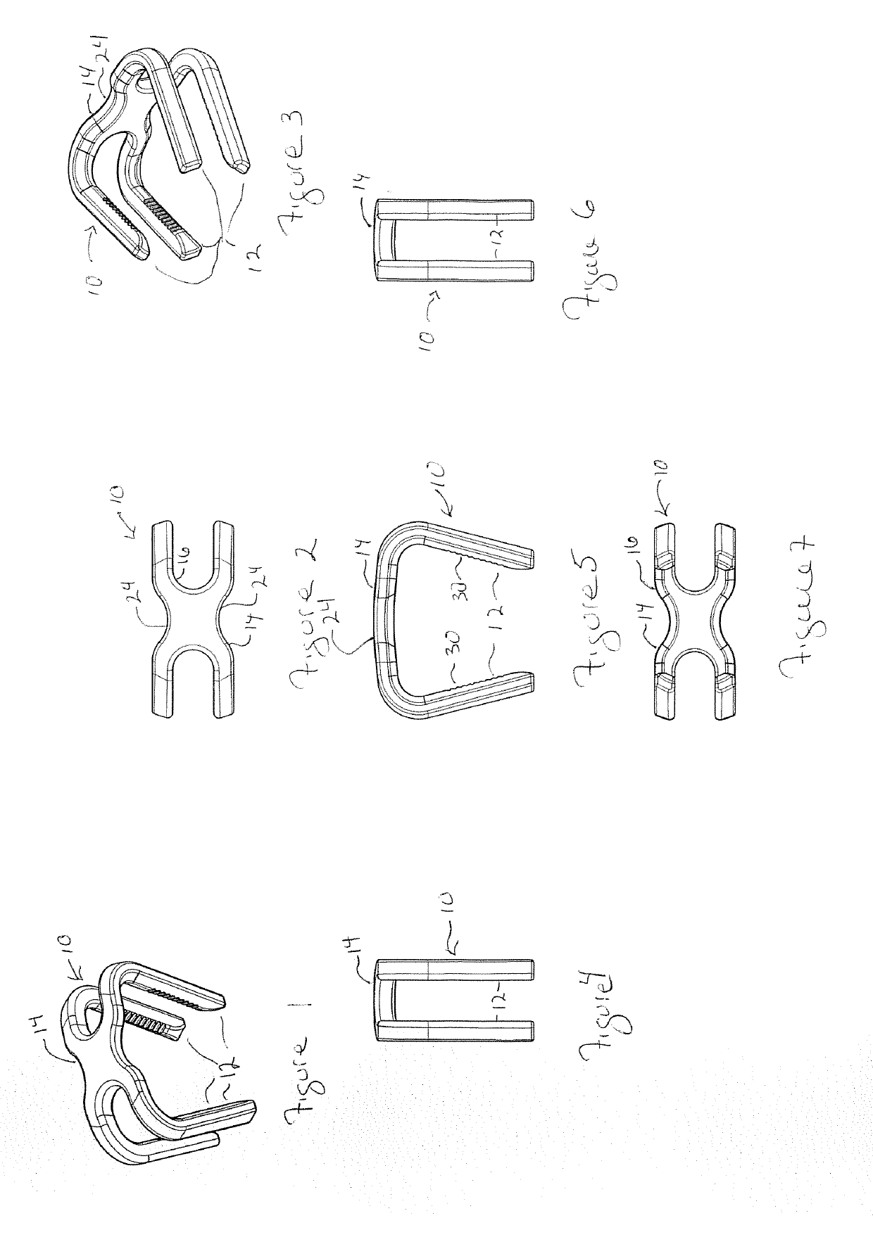 Superelastic bone compression staple